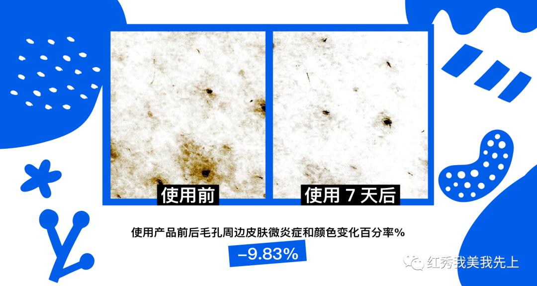 靠精华可以提升紧致吗,精华水可以收缩毛孔吗