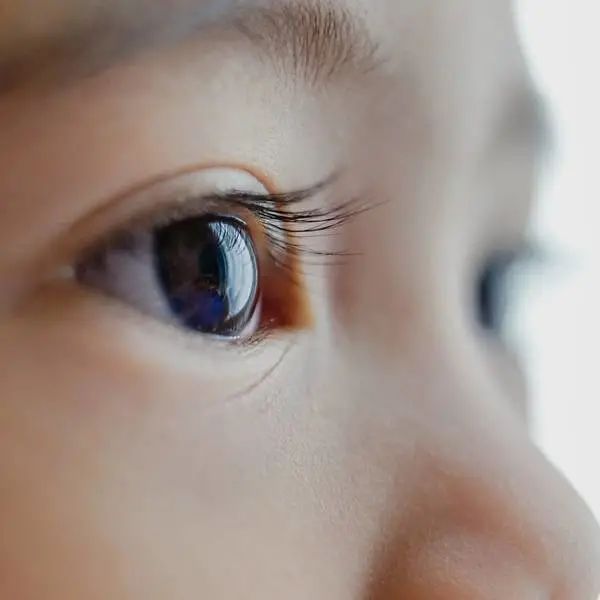 五岁半孩子眼睛散光需要干预吗,小孩眼睛散光跟家里灯光有关系吗