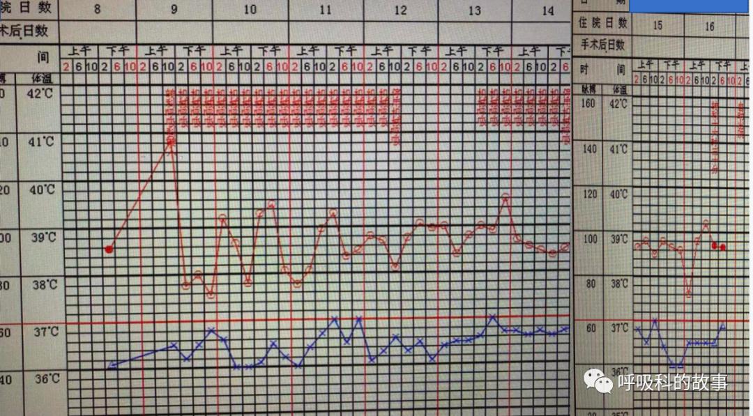 痰液培养阳性是否一定要用抗菌素?——为什么临床微生物学思维很重要(2)