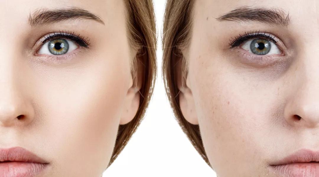 有眼纹和黑眼圈推荐使用的眼霜,适合有眼纹黑眼圈的眼霜