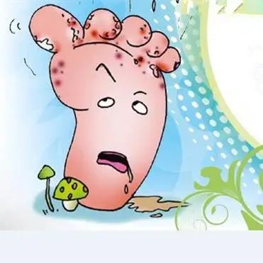 糖尿病足中医帮你消除截肢危险,警惕来自糖尿病足的截肢警告