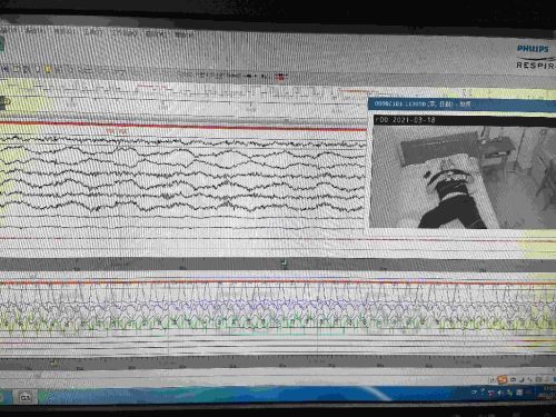 运动手环测睡眠准吗？实验对比专业睡眠监测看一看结论：手环就当简单的健康指导吧
