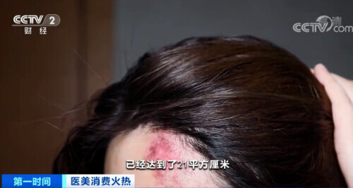 医院门诊排长队,医院里排长队