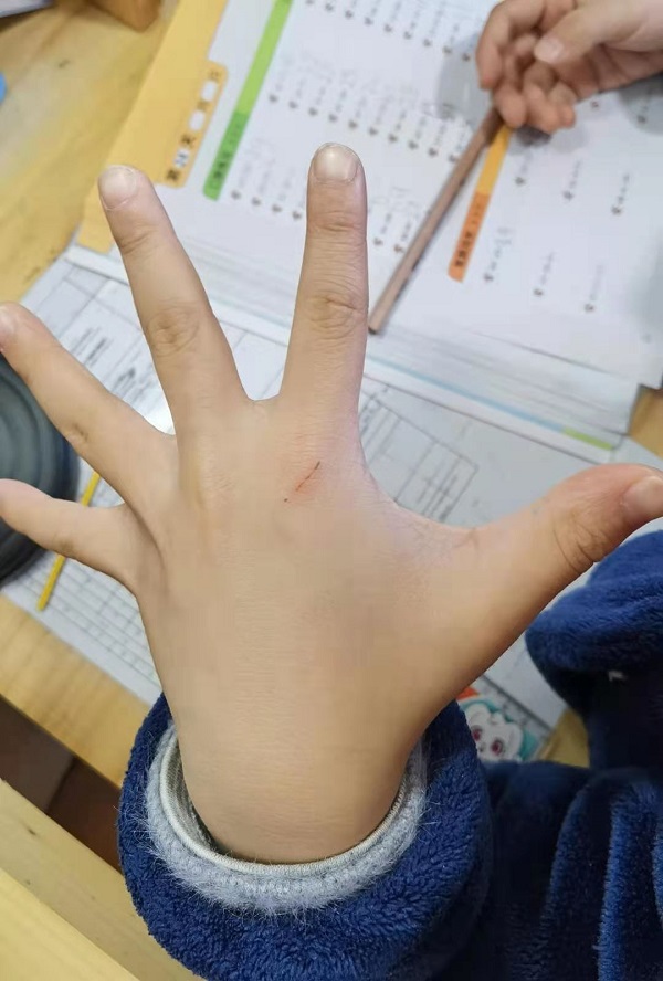 撸猫馆的猫咬人用打疫苗么,撸猫馆的猫抓破了怎么办