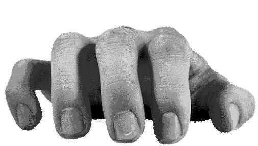 人体解剖的黑暗历史,人体解剖的黑暗故事