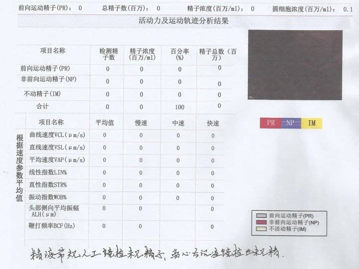 男子无精子用什么药,无精子症几个月后变有精子