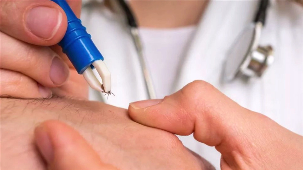 蜱虫疾病高发期省医院专家：被咬要尽快就医