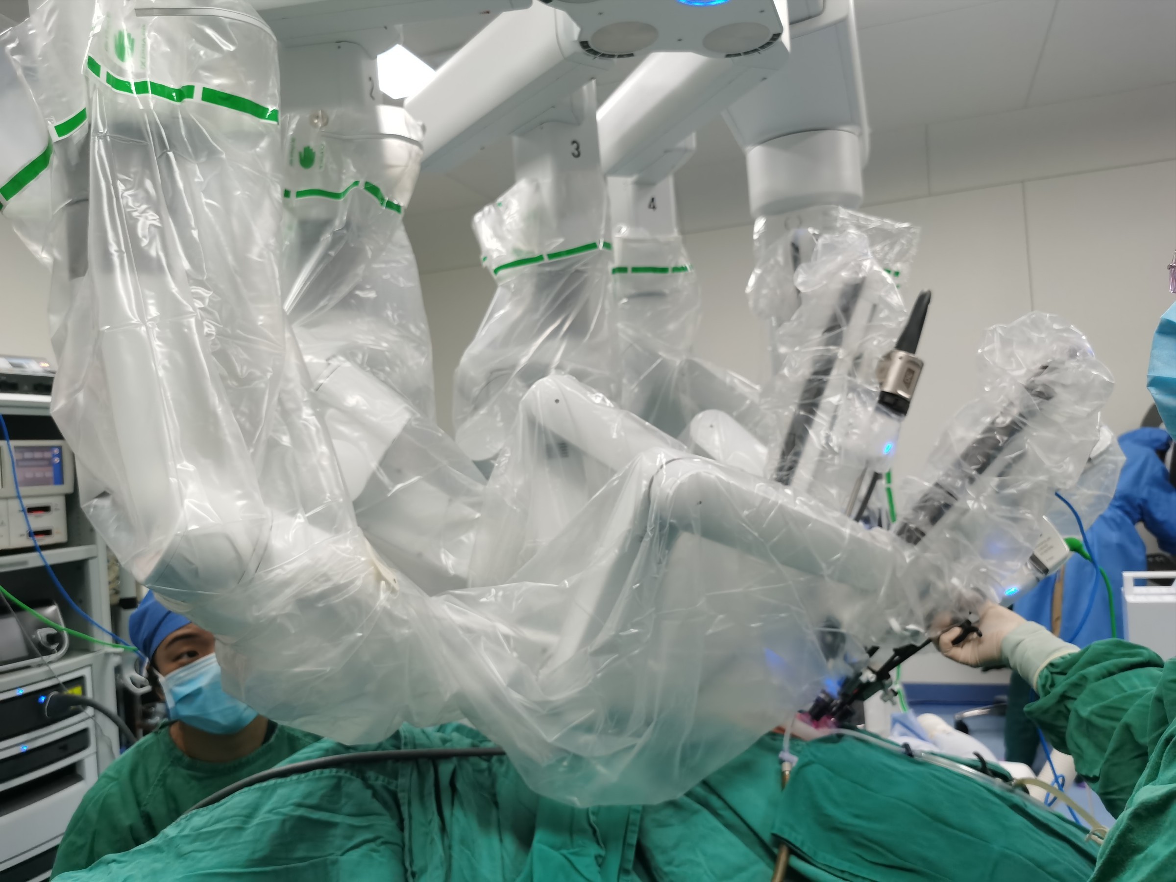 华西医院巨大肿瘤手术,四川华西达芬奇机器人手术