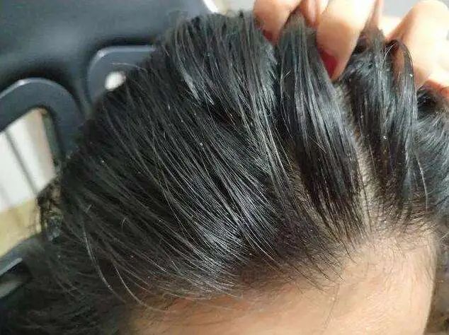 如何洗头让头发又柔顺又蓬松,洗头顺序怎么样才能让头发柔顺