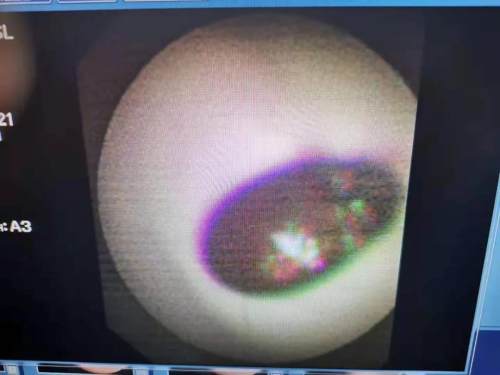 3岁孩子突然晚上睡觉打呼噜,3岁男宝宝睡觉打呼噜什么原因