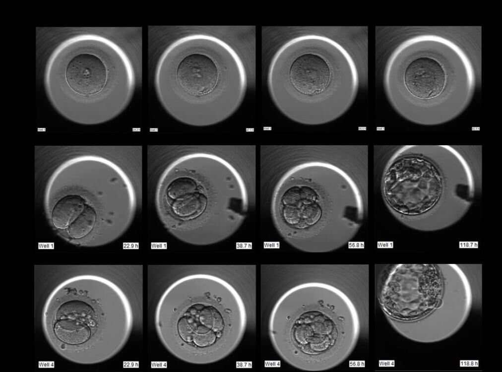 山大生殖医院男性不孕不育,山大生殖医院权威专家会诊