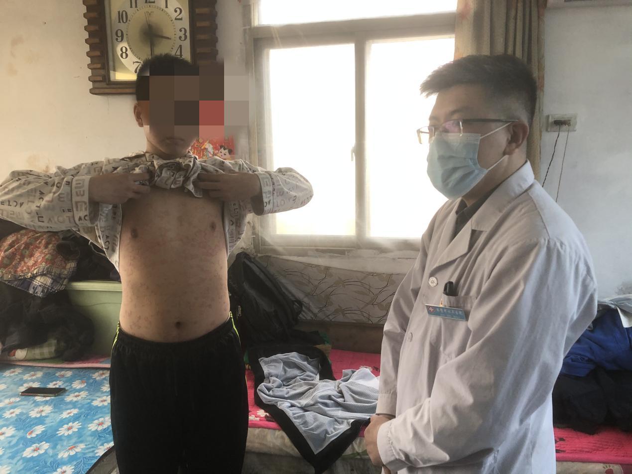 得了牛皮癣很绝望怎么办,求助谁能治好牛皮癣