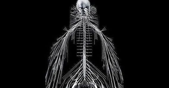 人体解剖的黑暗历史,人体解剖的黑暗故事