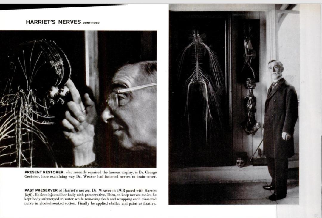 人体解剖的黑暗历史,人体解剖的黑暗故事