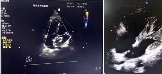 宿迁市钟吾医院心血管内科,钟吾医院宿迁