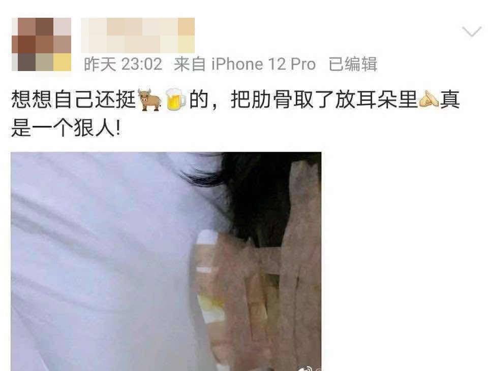 耳朵太大可以做整形变小么,如何让耳朵变成精灵耳