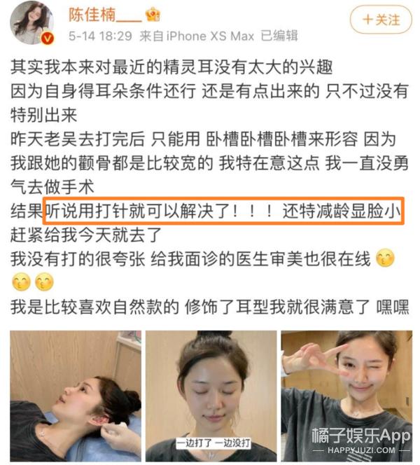 整容整腰,整容整的满脸高科技却一点不高级