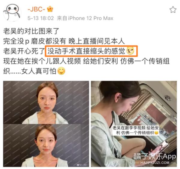 整容整腰,整容整的满脸高科技却一点不高级