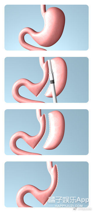整容整腰,整容整的满脸高科技却一点不高级