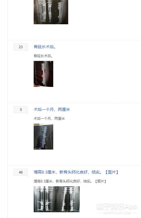 整容整腰,整容整的满脸高科技却一点不高级