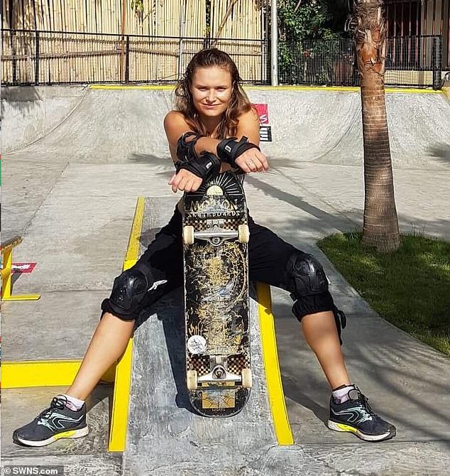 荨麻疹一精神紧张就浑身刺痛,过敏荨麻疹真是苦不堪言