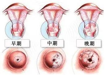 妇幼保健院卵巢肿瘤手术,九江市妇幼保健院肿瘤科