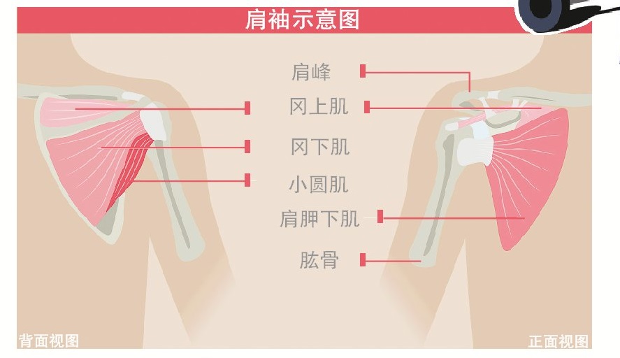 肩疼不一定是肩膀问题,肩膀痛警惕四种病肩周炎