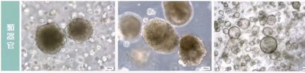 “复制”癌变器官帮患者试药？这种测试已在香港推出