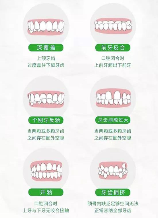 隐形矫治器一般多少钱,隐形矫正特惠价格