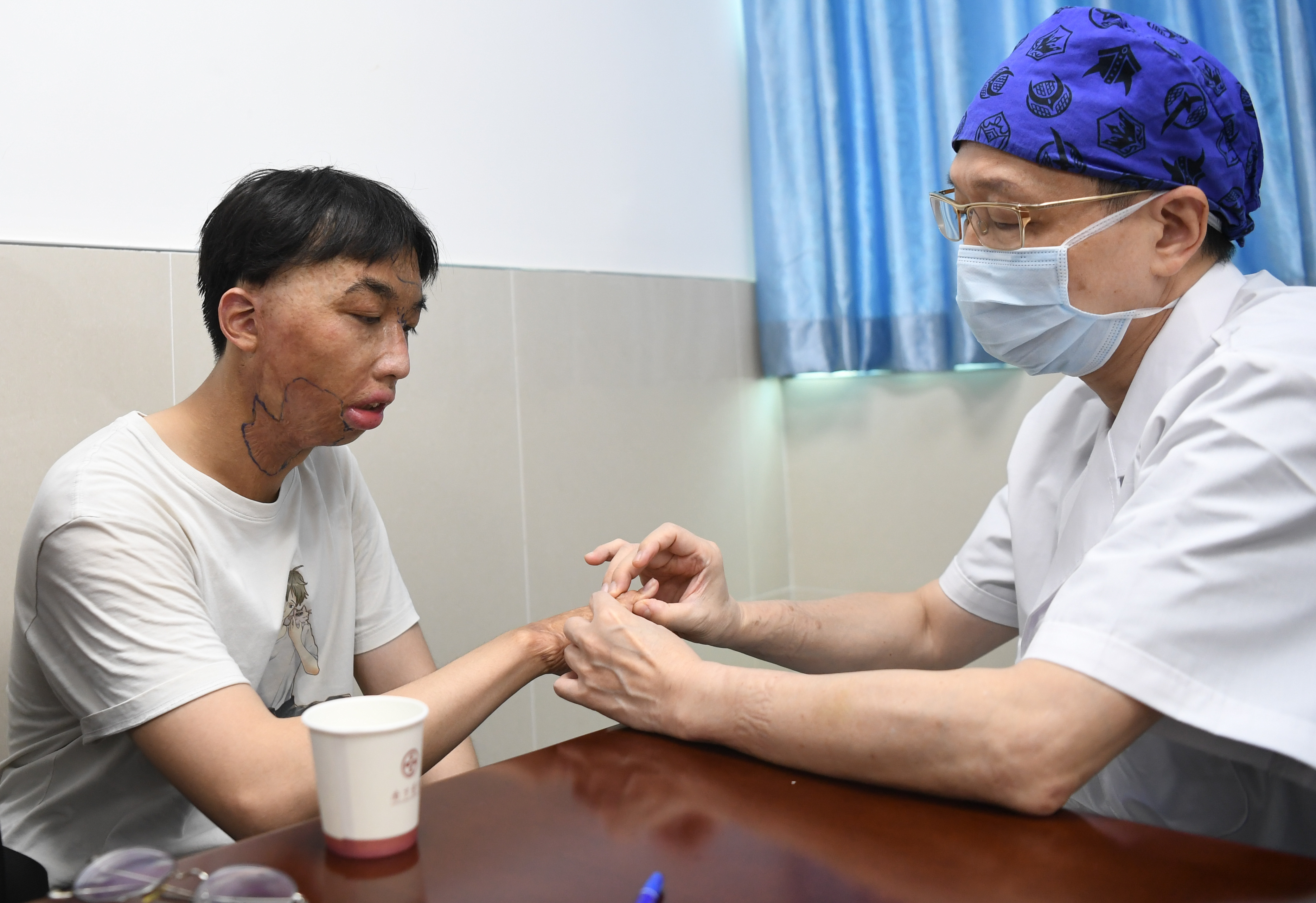 面具男孩,面具男孩治好了吗