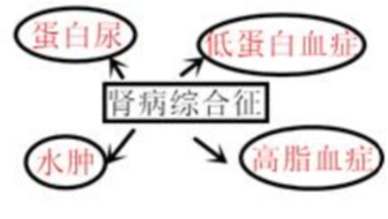 儿童双眼水肿什么原因,幼儿肾病眼睑浮肿眼睛流泪
