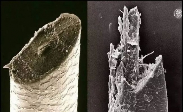 古巴变性手术,去国外做变性手术需要什么手续