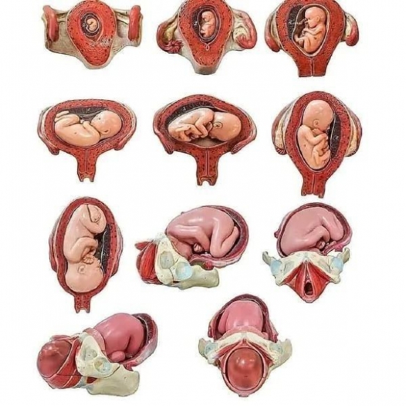 古巴变性手术,去国外做变性手术需要什么手续