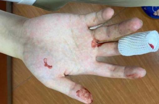 深圳无人机导致飞机迫降,大疆自动返航途中炸机怎么办