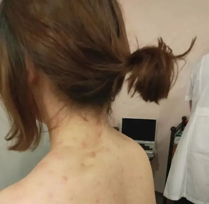 胸部填充手术,女胸部填充手术