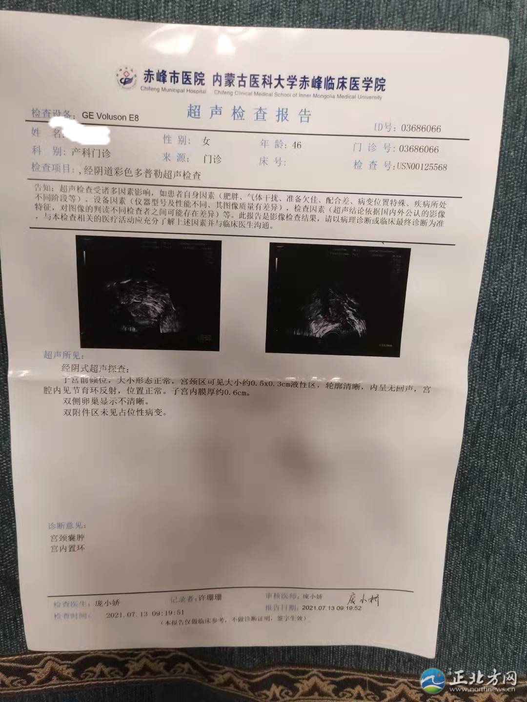 郭女士取环手术半年后环还在,记者采访被报警……