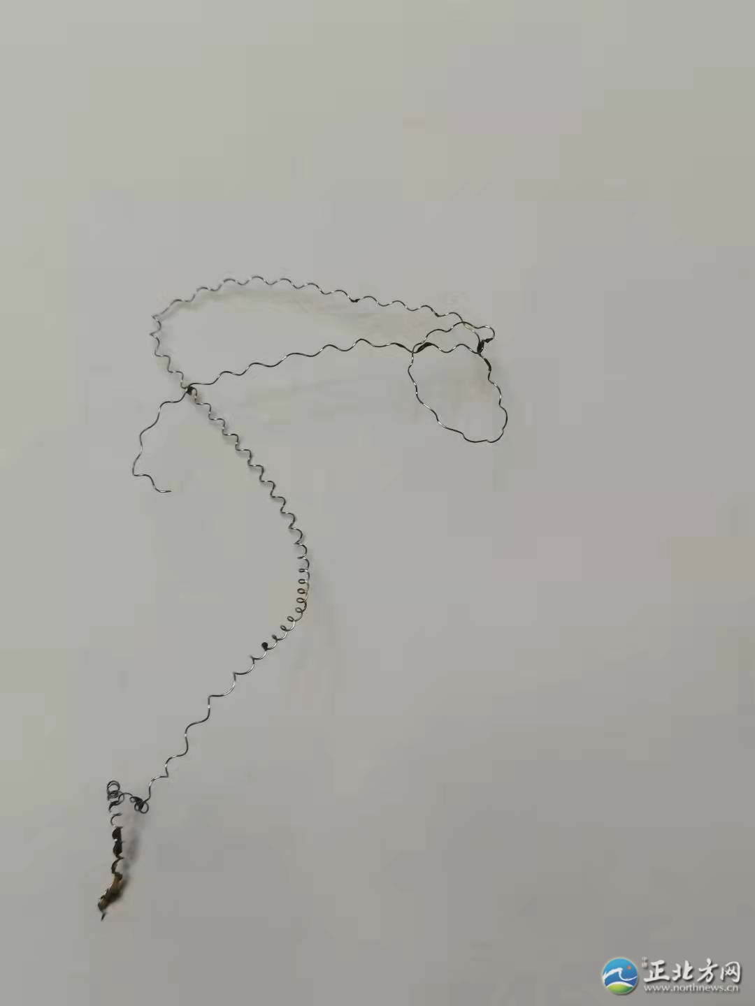 郭女士取环手术半年后环还在,记者采访被报警……