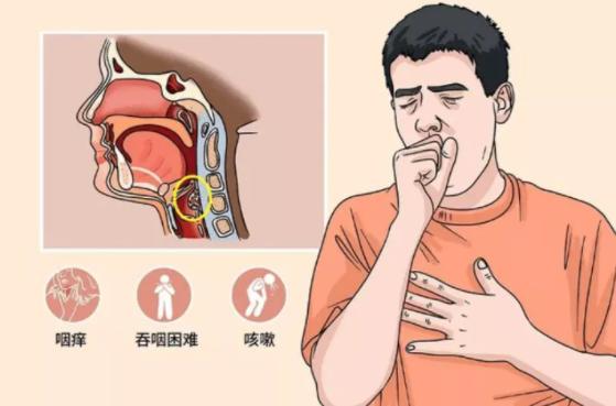 长期咽炎职业病吃啥药好,教师慢性咽喉炎怎么办