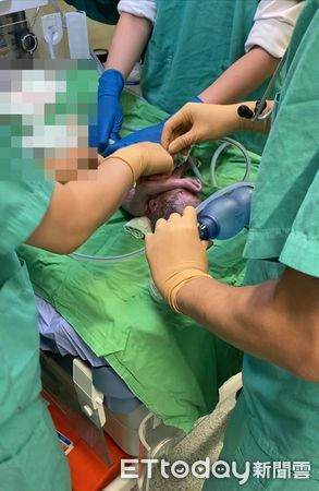 25医护救新生儿！「墙上都是血」婴全身发紫4张照逼哭网友