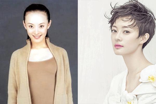 发际线高怎么办最快最有效,发际线高怎么办女孩