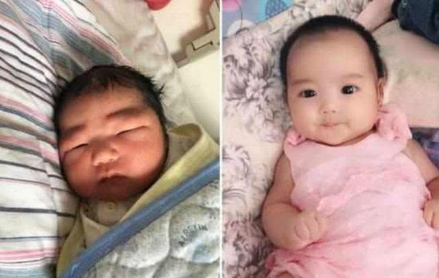 天生特别好看的孩子基因缺陷,长得高的孩子有哪些特征