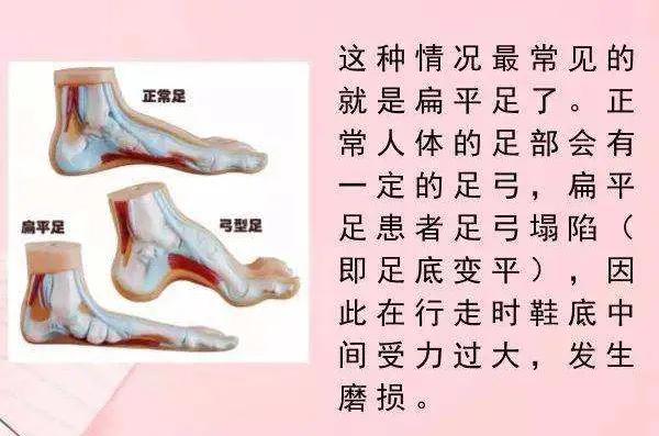 关注“跑偏”的鞋子,提示你的健康问题!