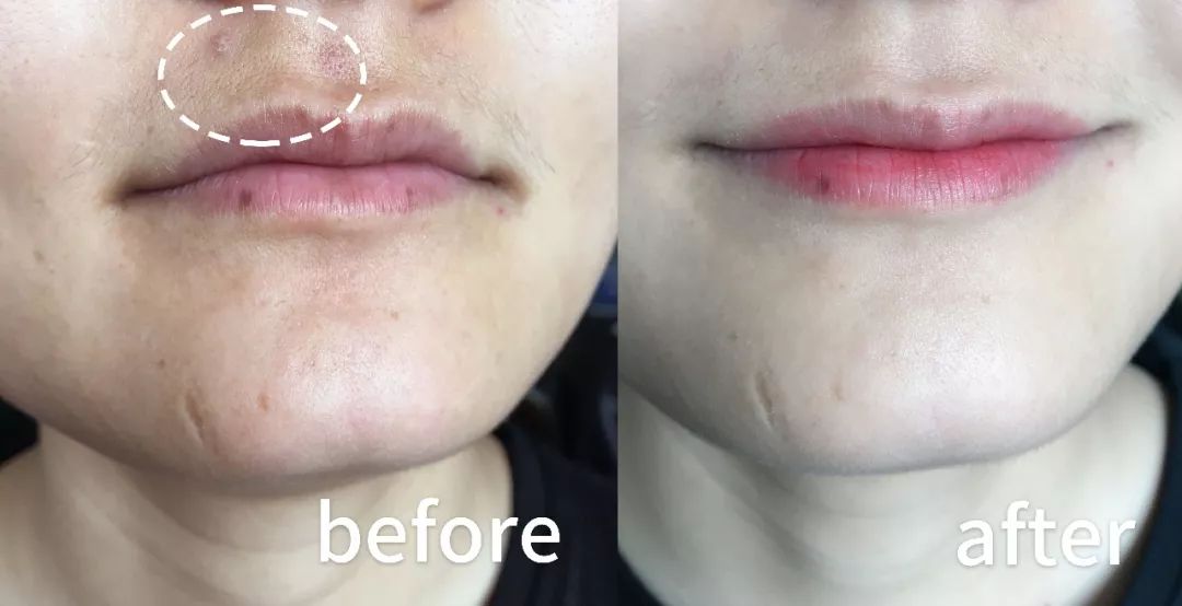 女神李冰冰私藏的补水减龄神器,用完皮肤超好,素颜也敢出门