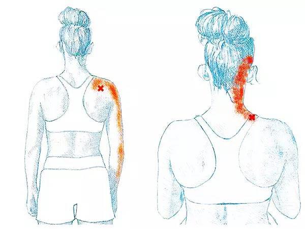 常见麻木病因和治疗方法,手部麻木的7种常见病因