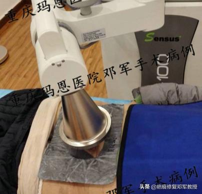 剖腹产疤痕增生特别痒怎么办,剖腹产疤痕增生凸起一条红肉