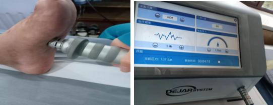 冲击波治疗两次见效果,冲击波治疗一次后还是疼