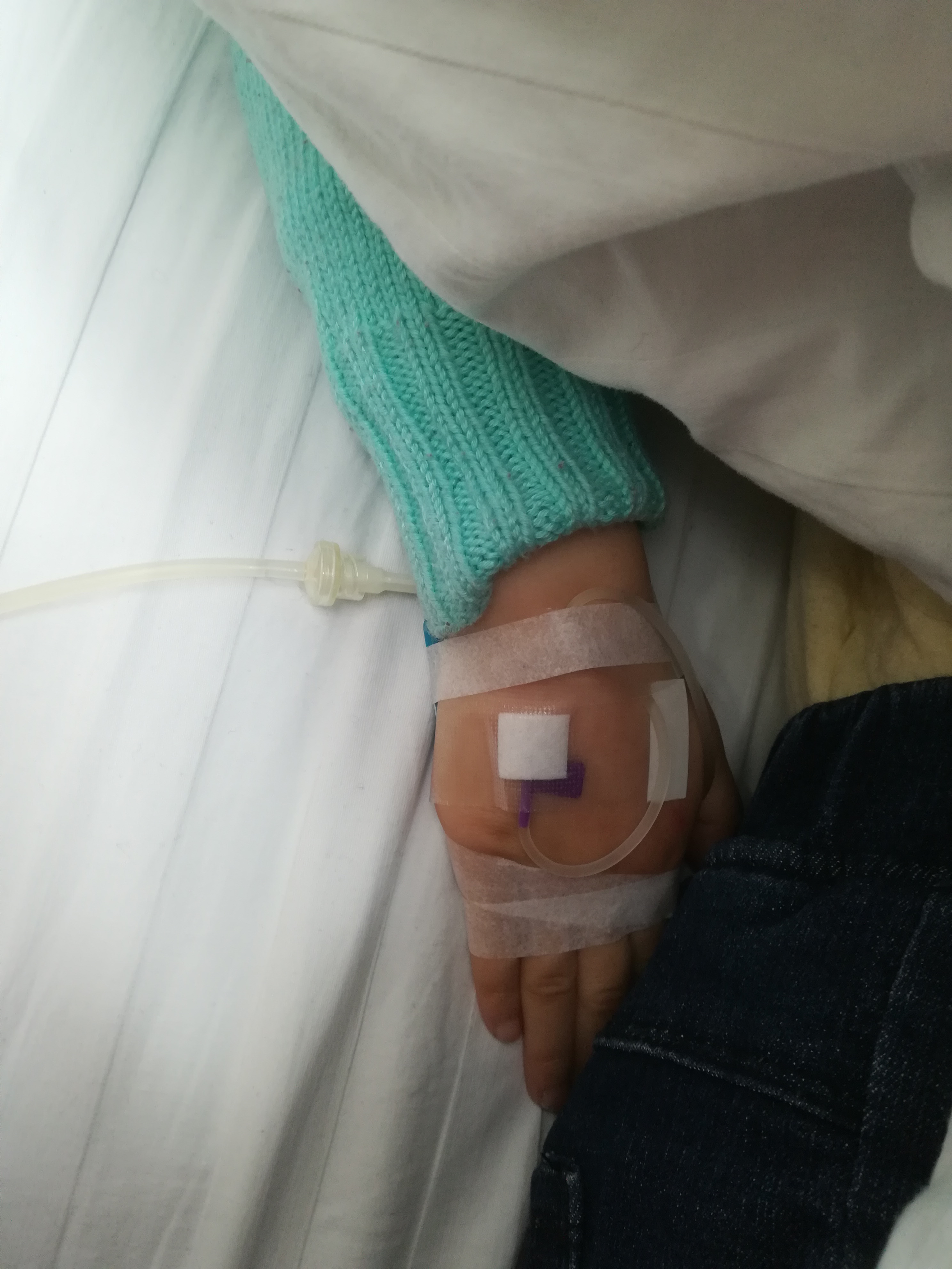 流感发烧40度需要挂水吗,高烧39-40一直不退