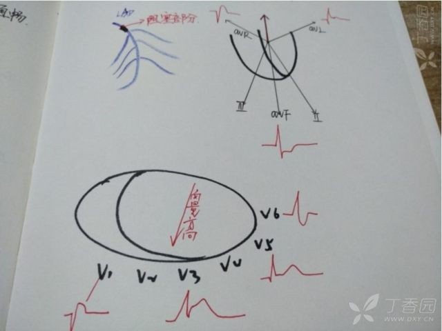 心电图心肌缺血冠脉造影正常,心脏彩超心电图冠脉造影正常