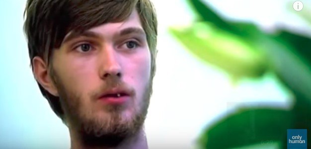 小孩长期不刷牙后果真实视频,长时间不刷牙竟然这么可怕