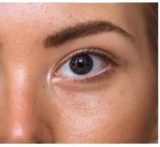 洗脸清洗黑头,洗脸清洁去粉刺